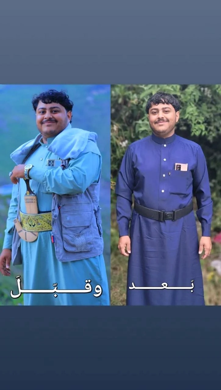 خسارة الوزن - قبل وبعد